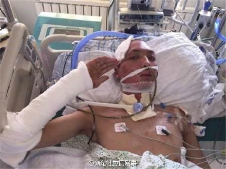 天津爆炸受伤消防员昏迷1个月后终于醒来