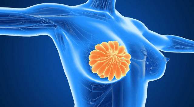 女人患乳腺癌和胸大小有关吗？