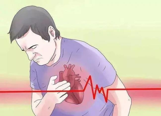 有一种心绞痛可能随时会转为急性心肌梗死