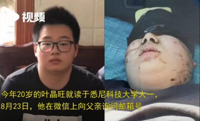 中国留学生被华裔绑架10天 面部惊现血洞惨不忍睹