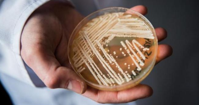 “超级细菌”危机！30年内可夺40万加拿大人性命