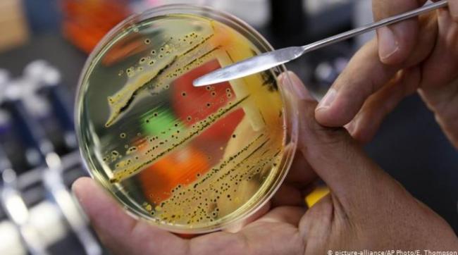 “超级细菌”危机！30年内可夺40万加拿大人性命