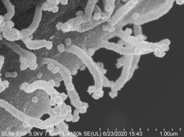 电子显微镜下惊人照片：病毒伸出“触手”射毒…