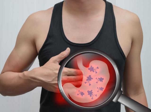 胃炎到胃癌只需三步 这些症状出现要小心