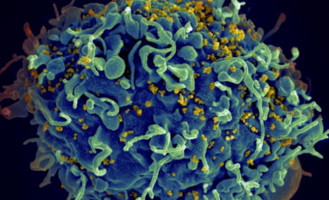 加国研究员重大发现:可引导免疫清除艾滋病病毒