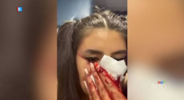恐怖慎入：26岁女子当街惨遭刀片切脸、差点瞎了