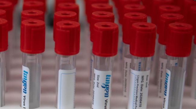 6万人！强生新冠病毒疫苗进入最后阶段试验