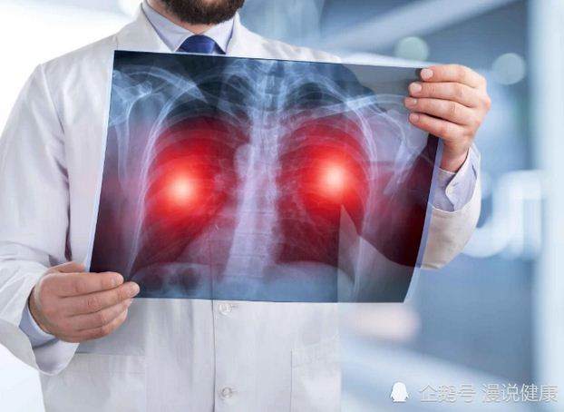 医生：身体这些异常 都是肺部癌变信号