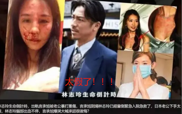 林志玲夫妻力破家暴传闻 脸上并没有伤疤
