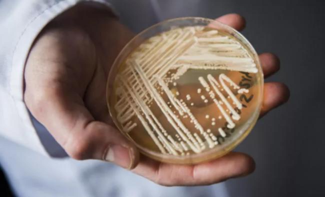 美国爆超级真菌疫情可人传人 一半病例90天死亡