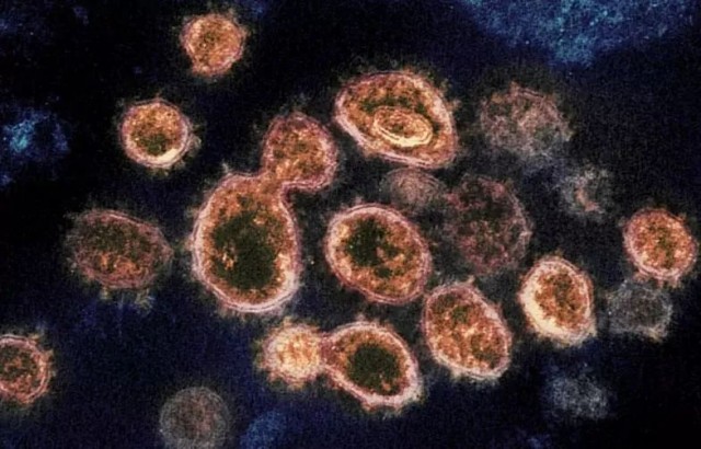UBC最新研究：Omicron病毒突变高达3至5倍