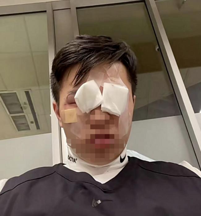 愤怒！多大19岁中国留学生遭群殴：血肉模糊、满脸是伤！