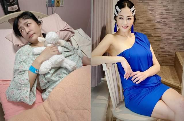 45岁女星唐玲证实癌症末期 医生断定最多半年