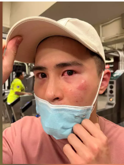 华裔观光客曼哈顿搭地铁无端被殴 报警遭冷处理
