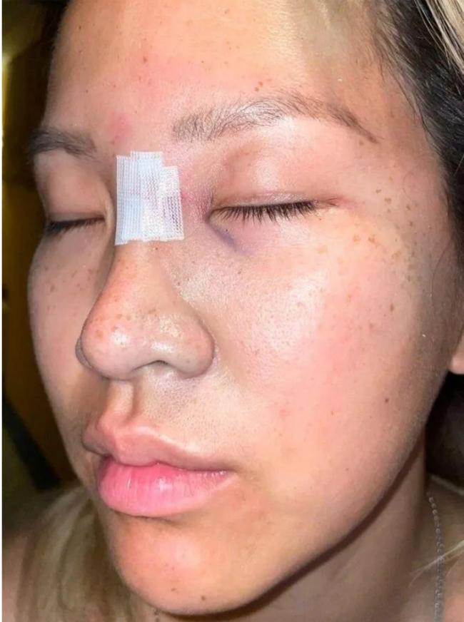 愤怒：华裔女子意大利度假被人辱骂并群殴