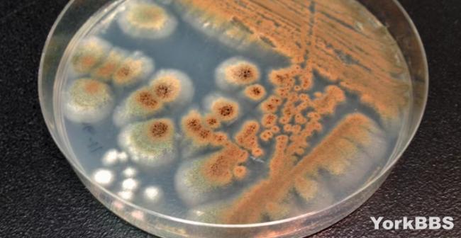 专家警告：真菌大流行全球人类变“僵尸”？