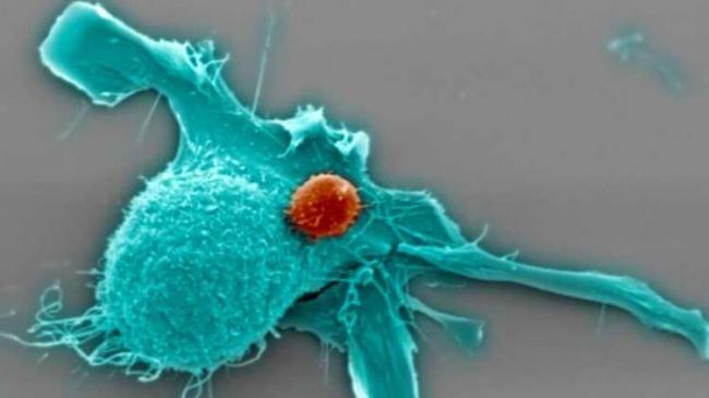 科学家研究发现：新冠病毒可能杀死癌细胞！？
