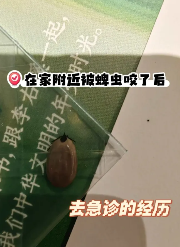 惊魂! 加拿大华人被毒虫叮咬:连夜急诊 账单惊人