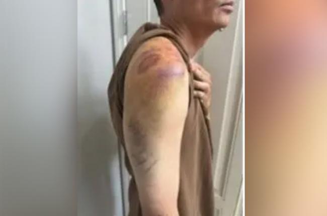 “中国来的Ｘ”华裔国安部干员 遭7警毒打+监禁