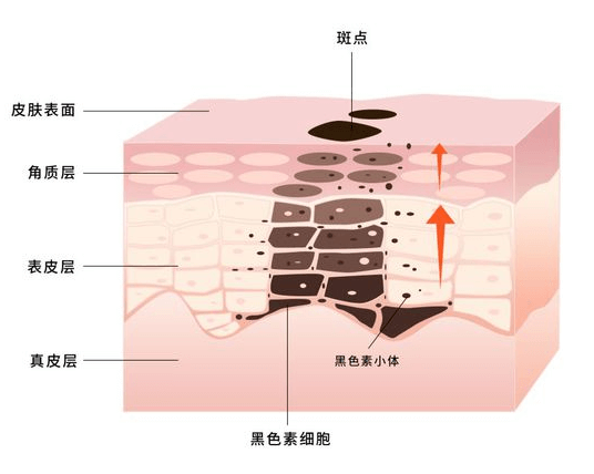 斑点淡化的有效方法 重拾无瑕美肌