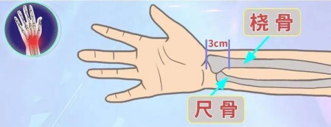 22岁小伙摔倒没当回事 7天后死亡