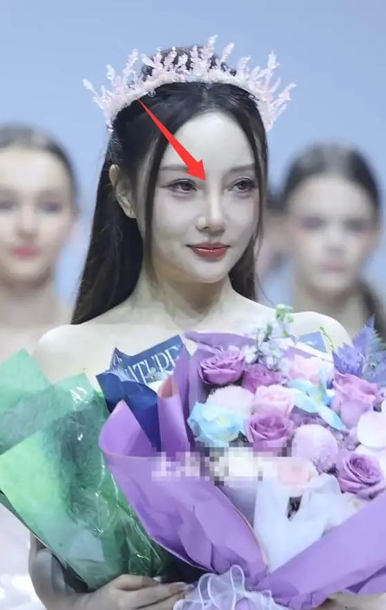 44岁李小璐现身难扛生图 卧蚕老鼻子变棍子