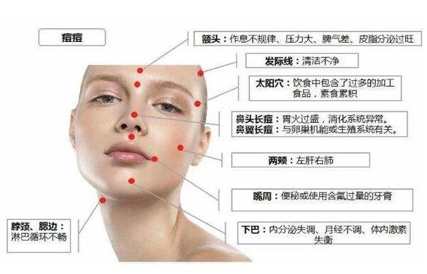 长痘痘的位置图解 长痘暗示身体出现了问题