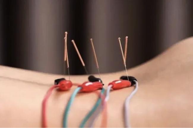 正服刑的73岁华裔针灸师突然想回家三天看亲人