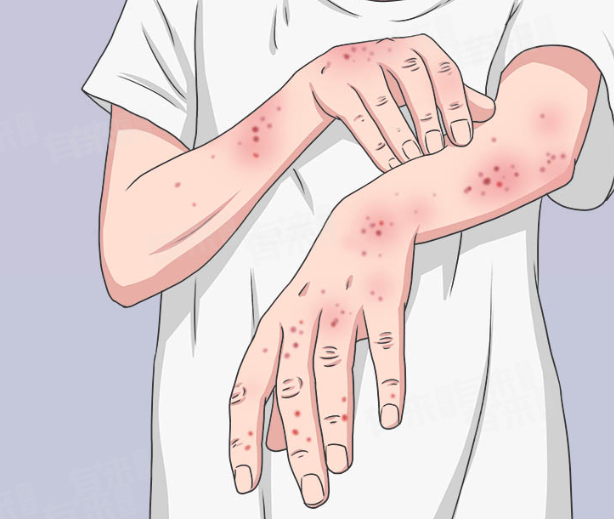 这些行为不会传染艾滋病 别再误解了