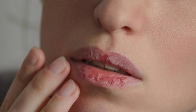 嘴巴一旦出现这3种异样 胃癌或已悄然临近 嘴巴一旦出现这3种异样 胃癌或已悄然临近