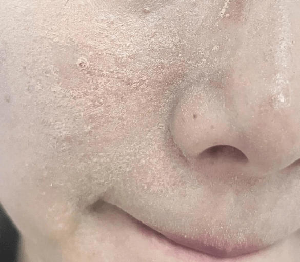 ���Ƥ��ױ���ۣ�ױǰ�������� ��ױ8Сʱ���߲�