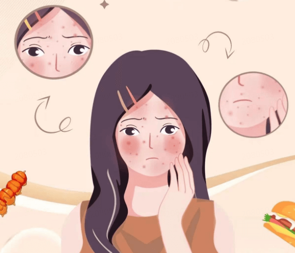 干敏皮护肤破局指南 温和保湿+屏障修复双管齐下