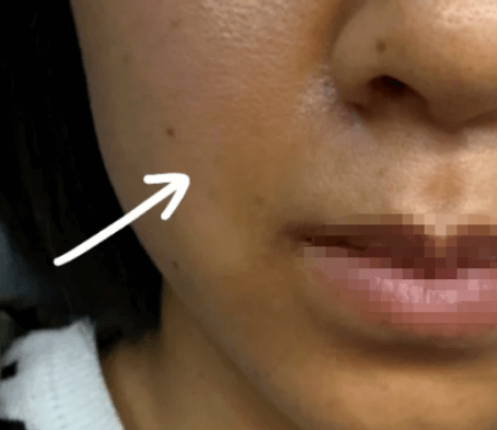 肤色暗沉别乱敷面膜 这6大根源才是“黄气元凶”