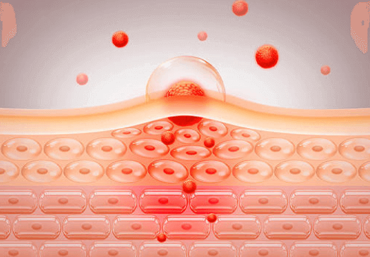 告别刺痛紧绷 精准保湿修复指南