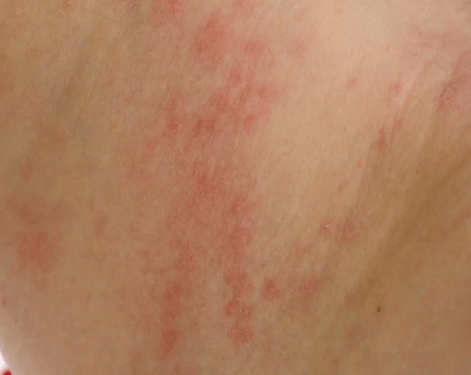 Ƥ����������Ī������ 3�����ԭ�������׼��Դ