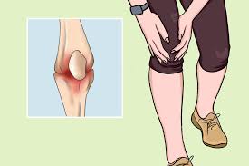 走路时腿突然软一下是怎么回事？是缺钙吗？