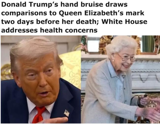 川普颈部惊现大片红斑, 伊朗开战后健康恶化?