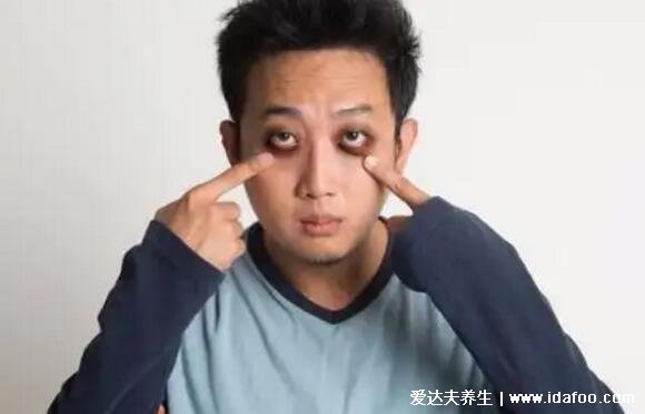 黑眼圈很严重是身体哪里出问题了 黑眼圈很严重是身体哪里出问题了