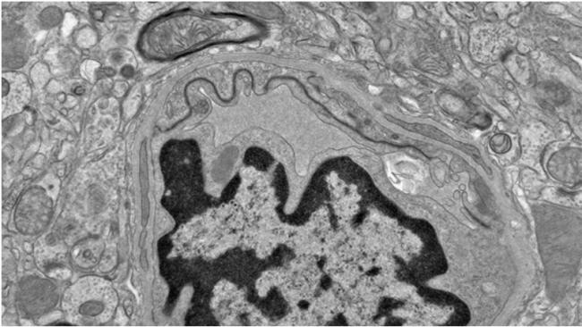 警告! 华人回国必带保健品翻车: 很多人不适合