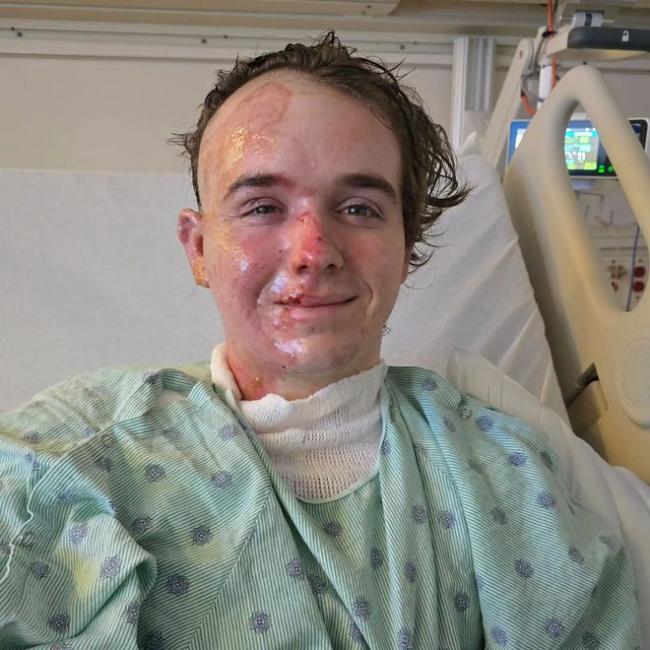 一转身, 一锅热油泼脸! 麦当劳经理刚求婚成功就遭同事无端袭击, 毁容重伤进ICU 一转身, 一锅热油泼脸! 麦当劳经理刚求婚成功就遭同事无端袭击, 毁容重伤进ICU