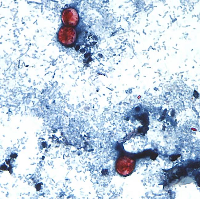 吃草莓/小葱等小心 爆发性腹泻寄生虫或蔓延加国