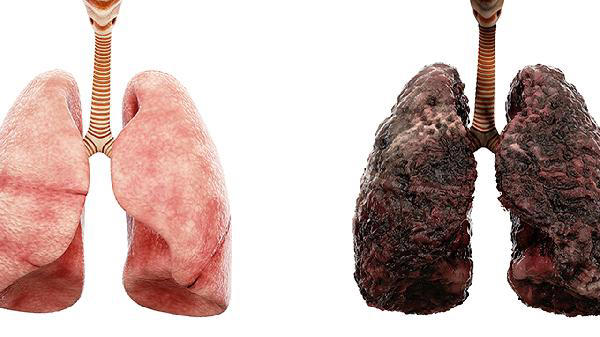 研究57万人表明:肚子大、个子高的人患癌风险高 研究57万人表明:肚子大、个子高的人患癌风险高